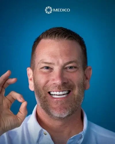 After treatment — Hollywood Smile, 🇺🇸 United States