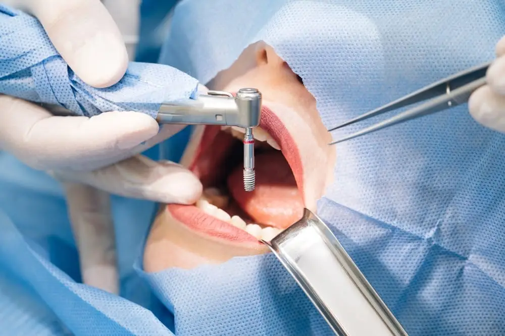 dental