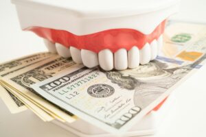 Treatment dental care cost, dental expense or fee, US dollar banknote money with teeth model.