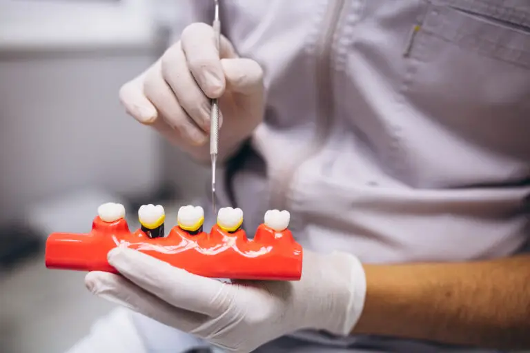 Dental Implant Abroad