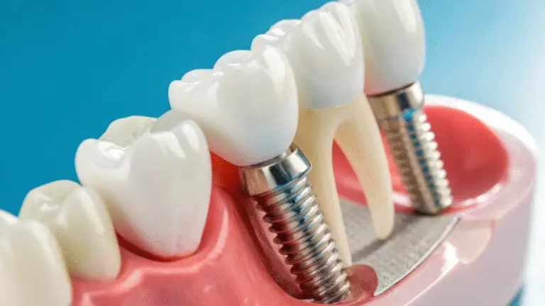 Dental implant