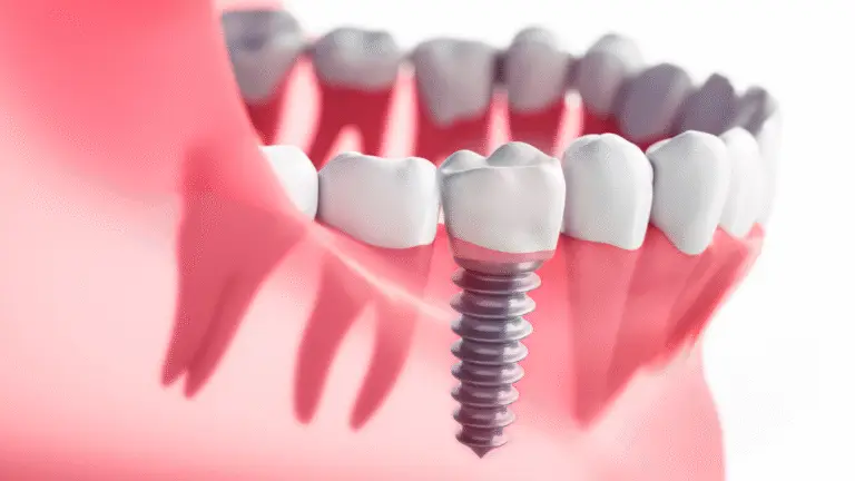 are Dental Implants painful