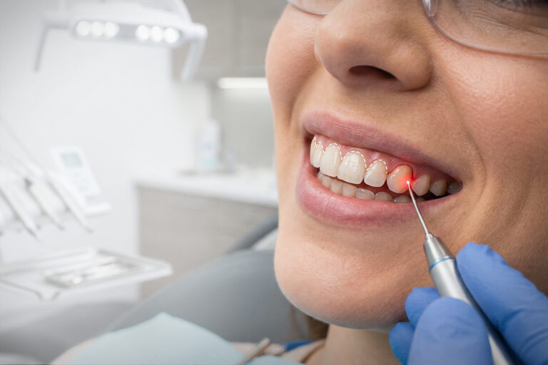Laser Gum Therapy