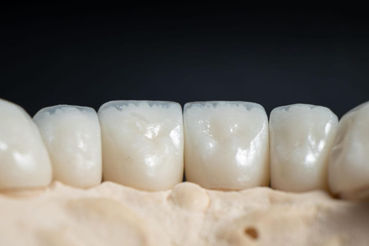 Zirconium Crowns