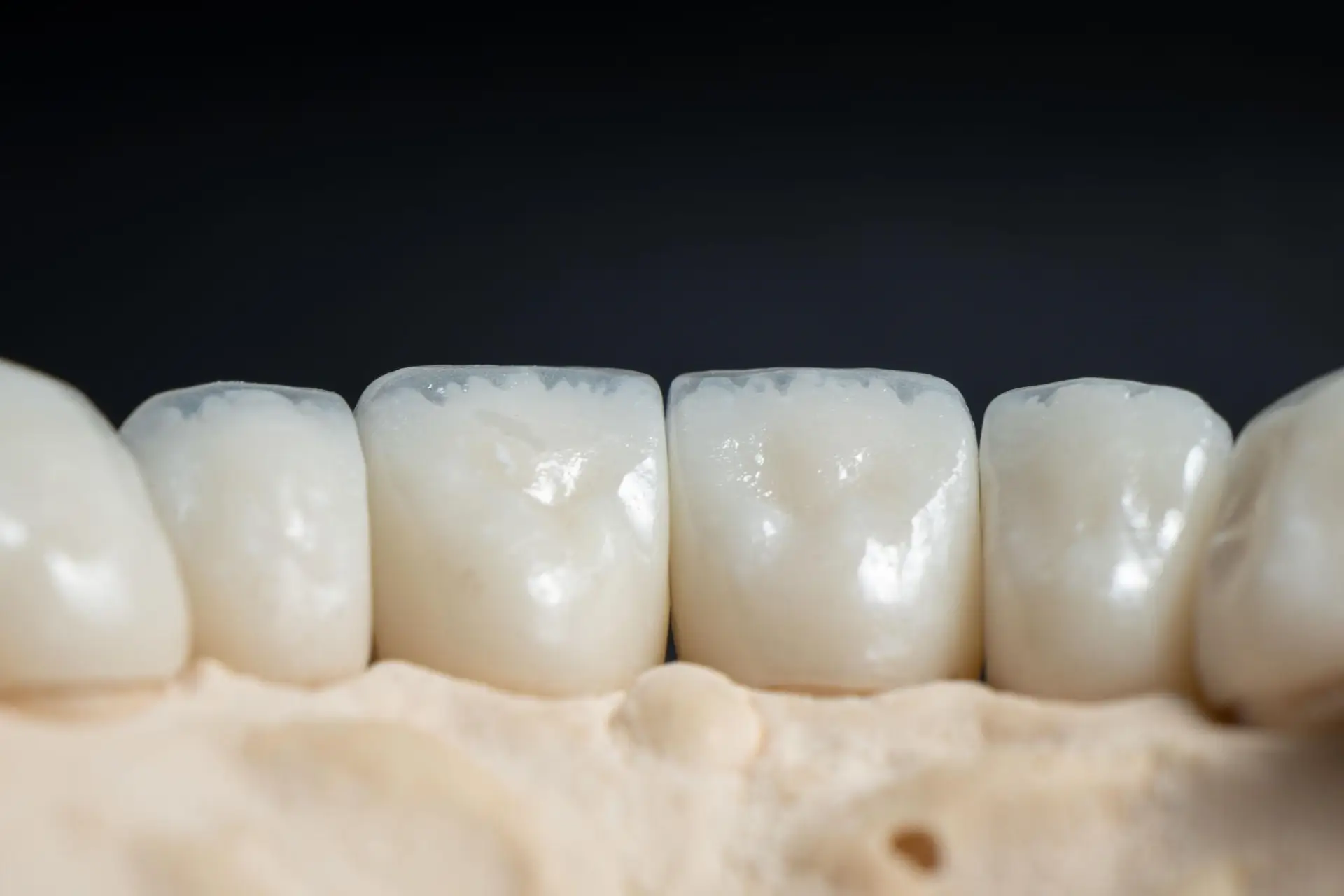 Zirconium Crowns