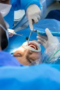 How Many Teeth Can Be Fixed on One Implant in Turkey?