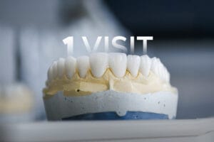 16 Zirconium Crowns in one visit