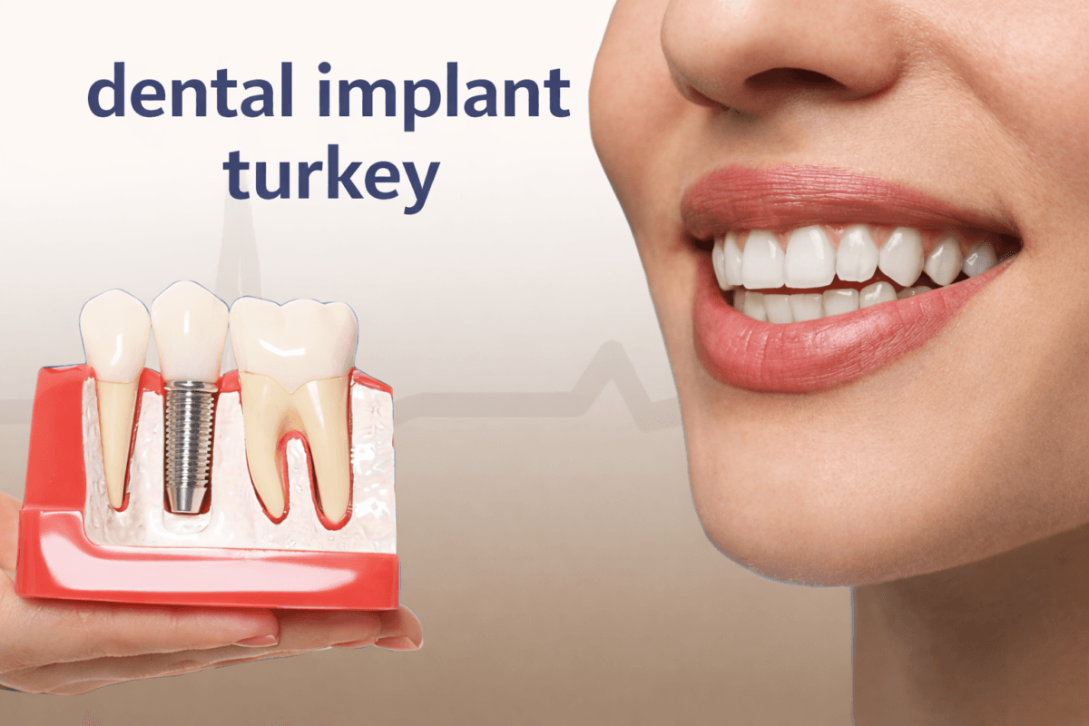 Dental Implant Turkey