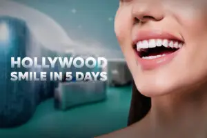 Hollywood Smile in 5 Days