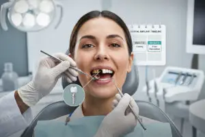 How Many Days Do You Need to Stay for Dental Implants Abroad?