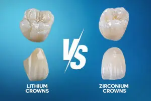 Zirconia vs Lithium Disilicate Crowns