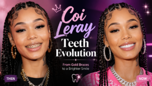 coı leray teeth evolution