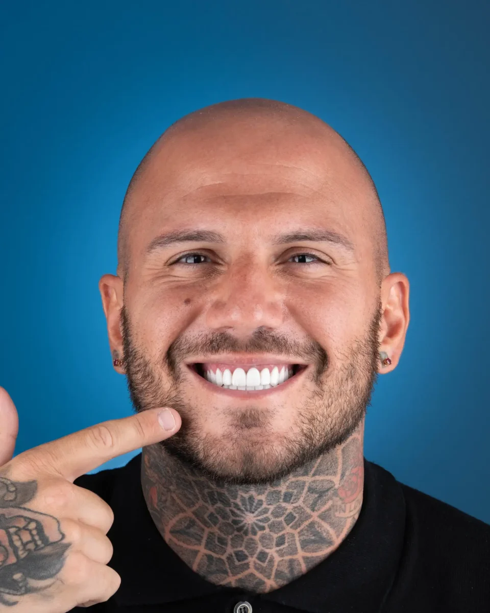 Straumann Dental Implants