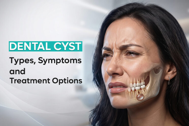 Dental-Cyst