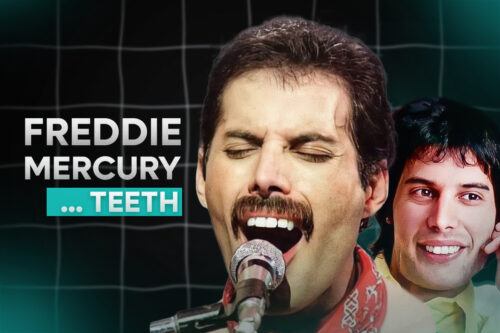 Freddie-Mercury-Teeth