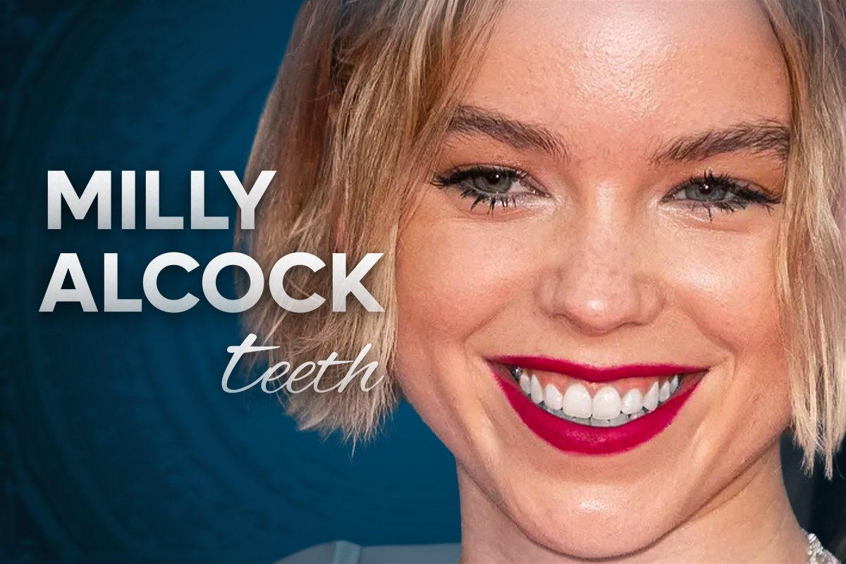 Milly Alcock Teeth