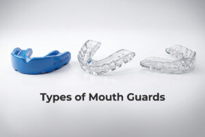 Types-of-Mouth-Guards